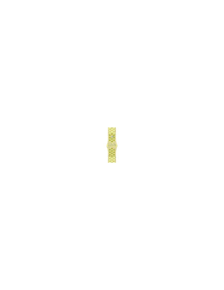 Apple MGA94ZM/A Accesorios para dispositivos vestibles inteligentes Grupo de rock Amarillo Aluminio, Fluoroelastómero