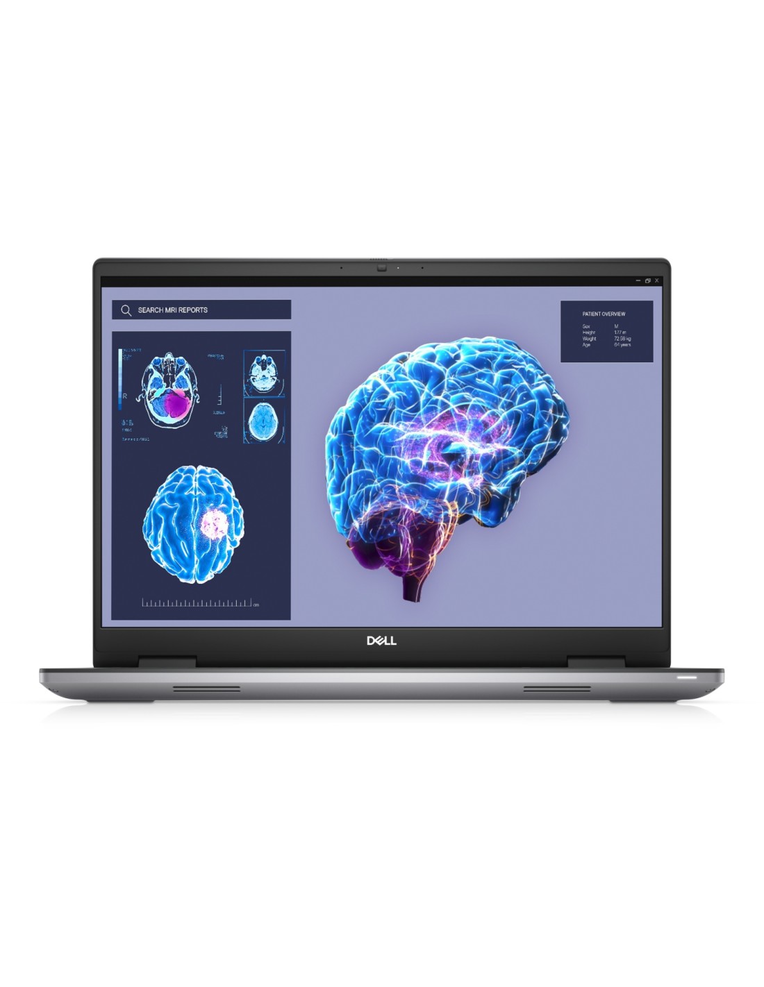 DELL Precision 7680 Intel® Core? i7 i7-13850HX Estación de trabajo móvil 40,6 cm (16") Full HD+ 32 GB DDR5-SDRAM 1 TB SSD NVIDIA